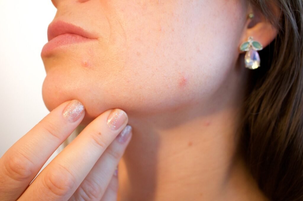 mejor retinol para combatir el acné de forma efectiva
